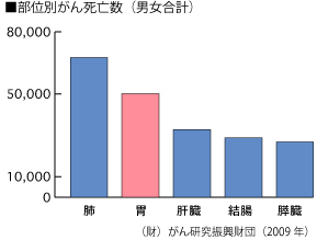 自覚 症状 胃がん