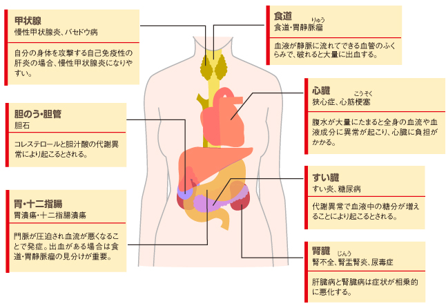 ん 肝臓 症状 が