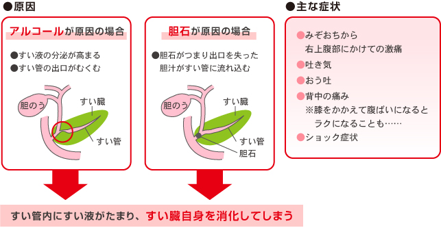 炎 慢性 すい