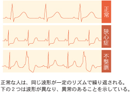 心電図