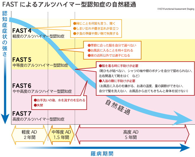 アルツハイマー型認知症の自然経過